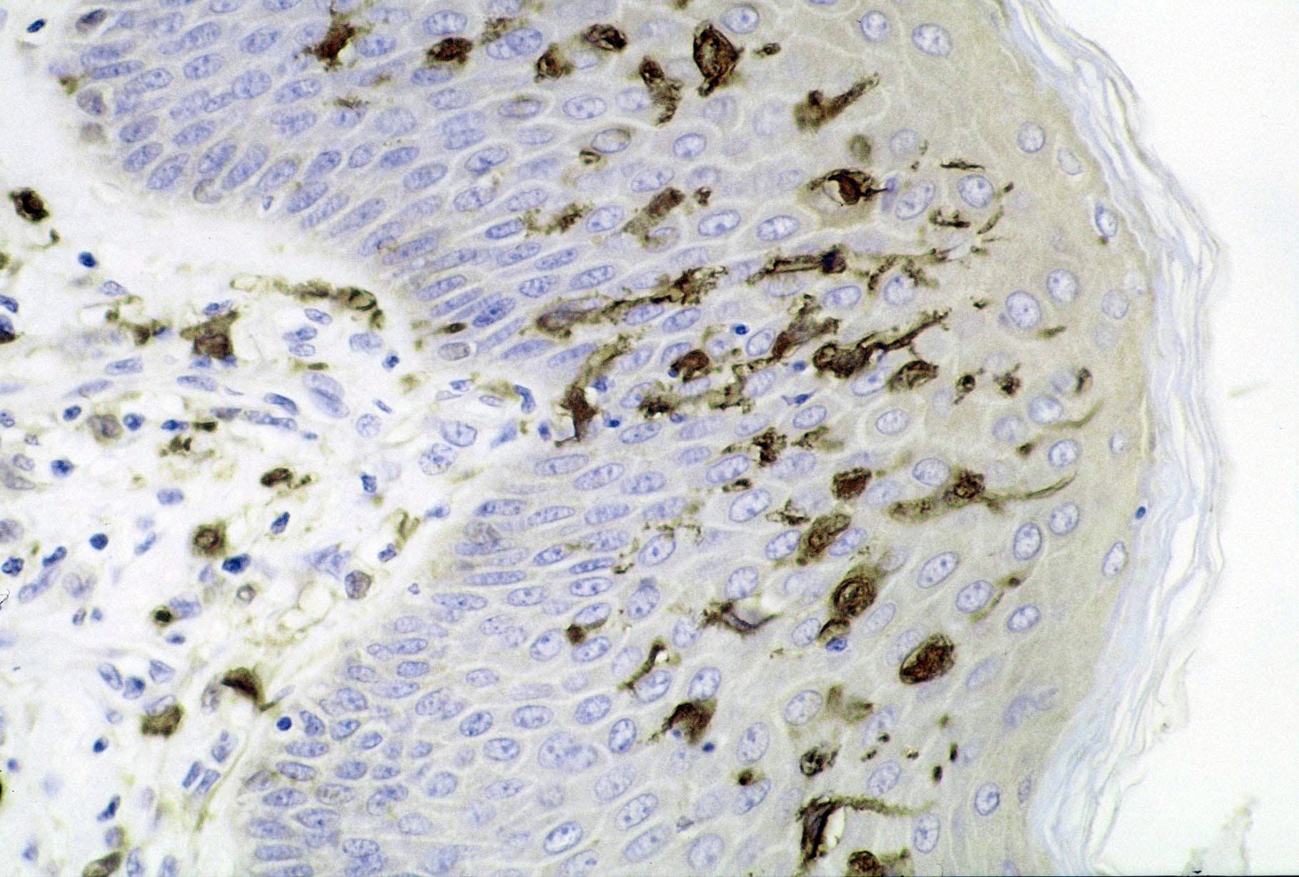 Dendritic Cell