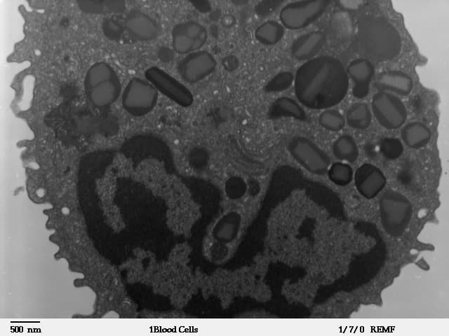 Eosinophil